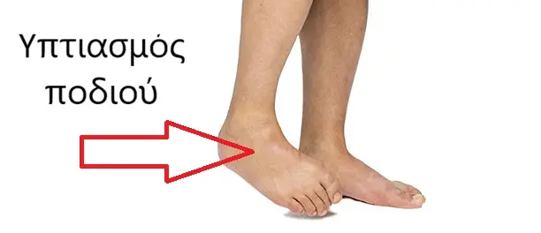 Μέθοδος Bobath Concept 3 Spastikotita kato akra